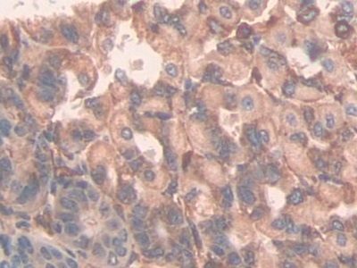 Polyclonal Antibody to Alanine Aminopeptidase (AAP)