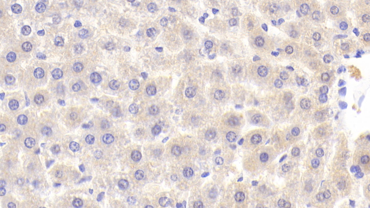 Polyclonal Antibody to Alanine Aminopeptidase (AAP)