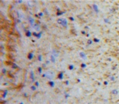 Polyclonal Antibody to Peptide YY (PYY)