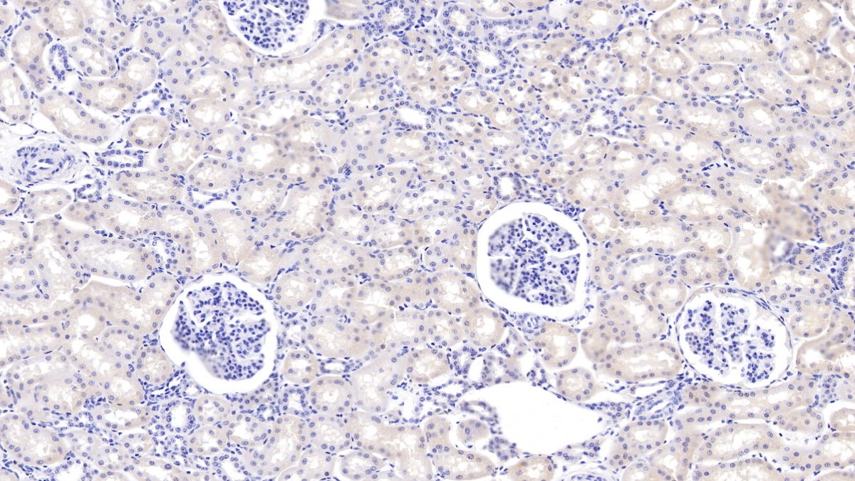Polyclonal Antibody to Polymeric Immunoglobulin Receptor (PIGR)