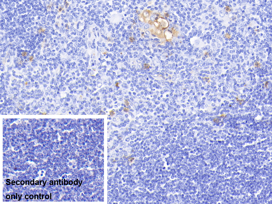 Polyclonal Antibody to S100 Calcium Binding Protein A12 (S100A12)