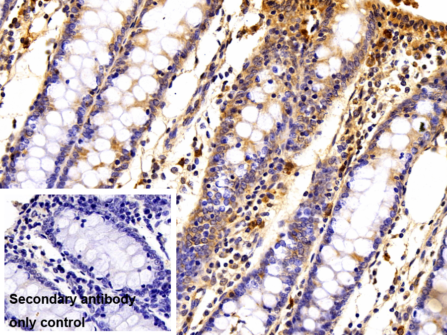 Polyclonal Antibody to S100 Calcium Binding Protein A12 (S100A12)