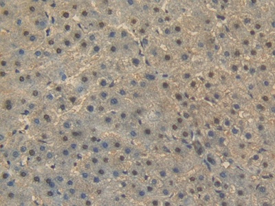 Polyclonal Antibody to Heat Shock 70kDa Protein 1A (HSPA1A)