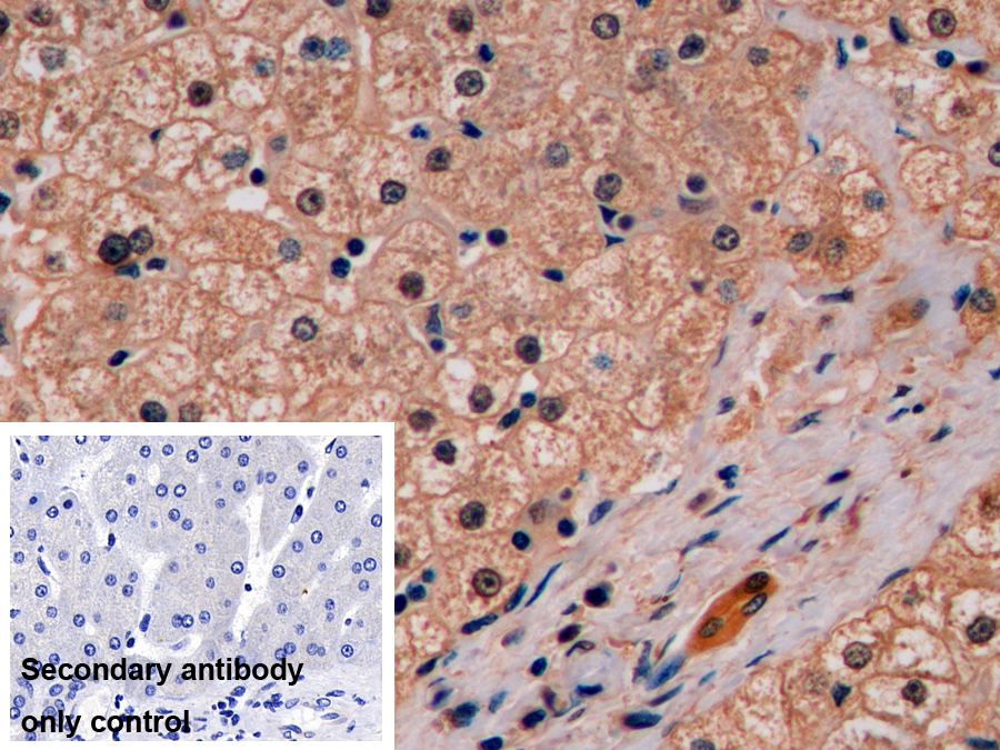 Polyclonal Antibody to Glutathione S Transferase Pi (GSTp)