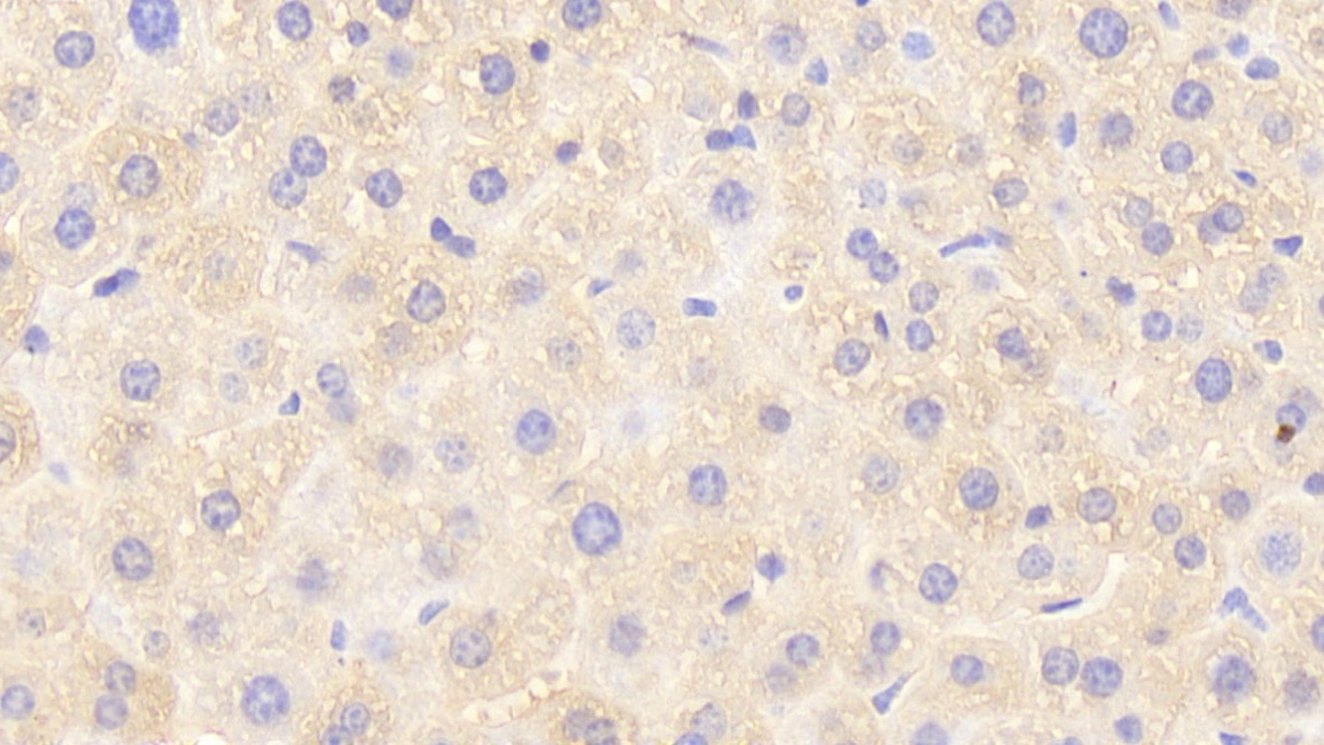 Polyclonal Antibody to Glutathione S Transferase Pi (GSTp)