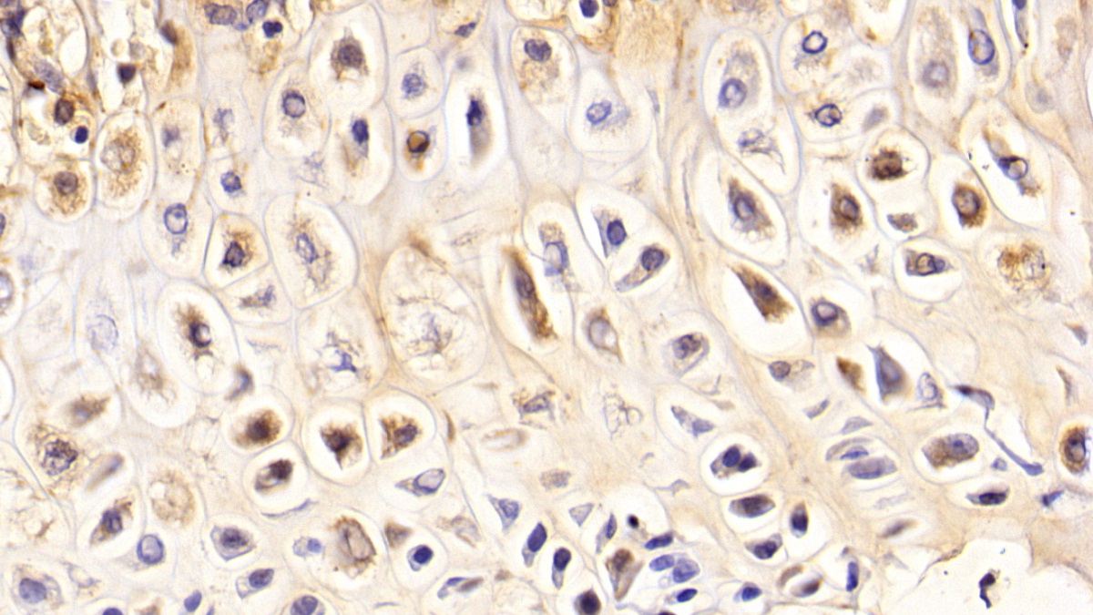 Polyclonal Antibody to Bone Sialoprotein (BSP)