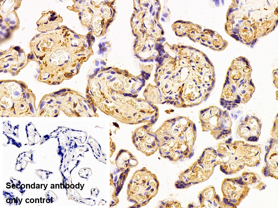 Polyclonal Antibody to Coagulation Factor XIII A1 Polypeptide (F13A1)