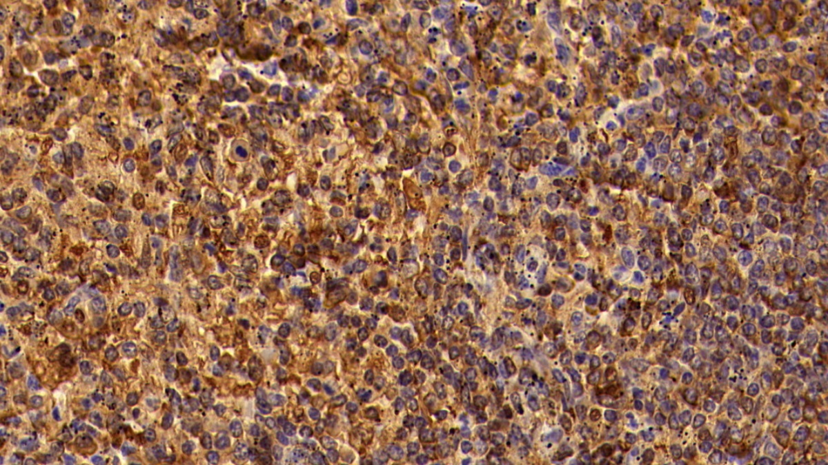 Polyclonal Antibody to Cluster Of Differentiation 8a (CD8a)