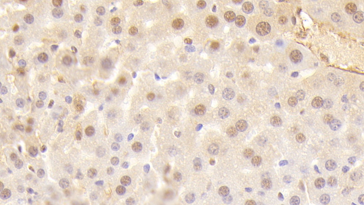 Polyclonal Antibody to Ectonucleoside Triphosphate Diphosphohydrolase 1 (ENTPD1)