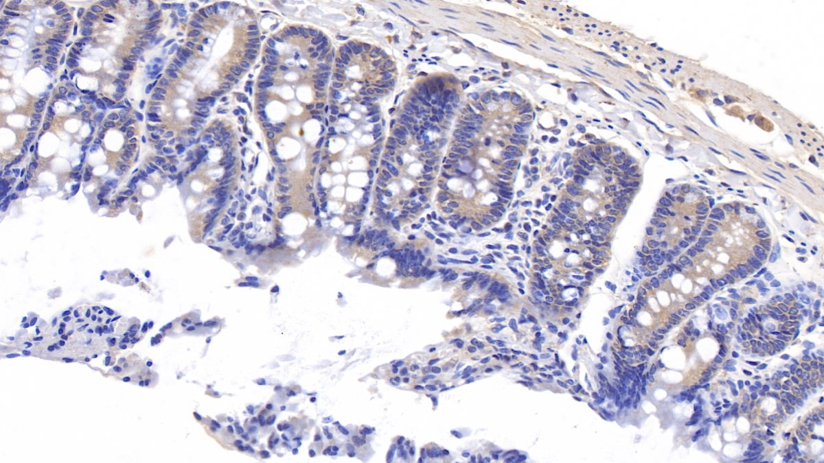 Polyclonal Antibody to Metallothionein 1 (MT1)