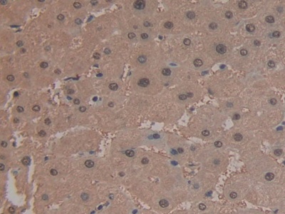 Polyclonal Antibody to Arginase (ARG)