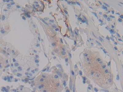 Polyclonal Antibody to Fibrinogen Alpha Chain (FGA)