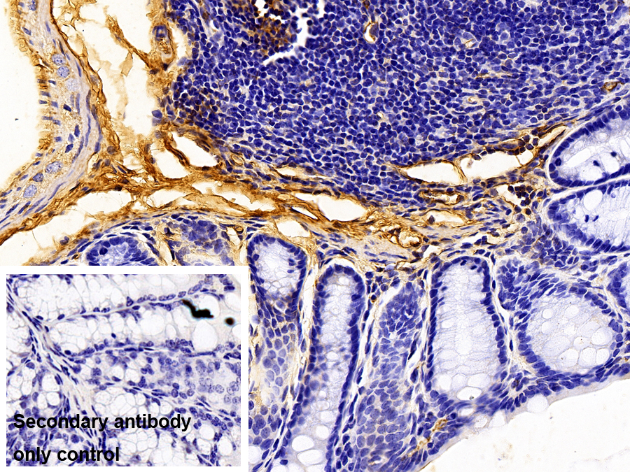 Polyclonal Antibody to Fibrinogen Alpha Chain (FGA)