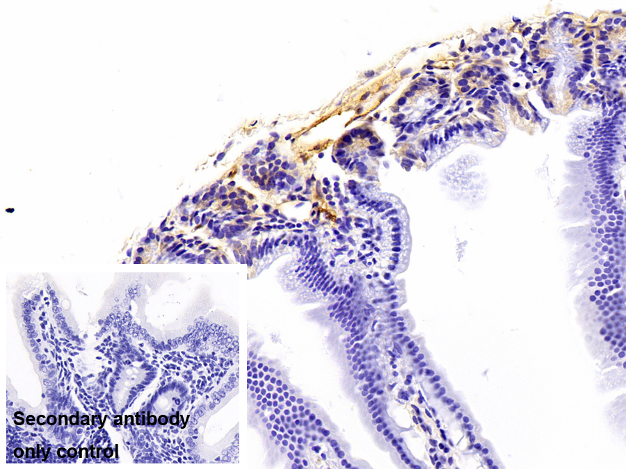 Polyclonal Antibody to Fibrinogen Alpha Chain (FGA)