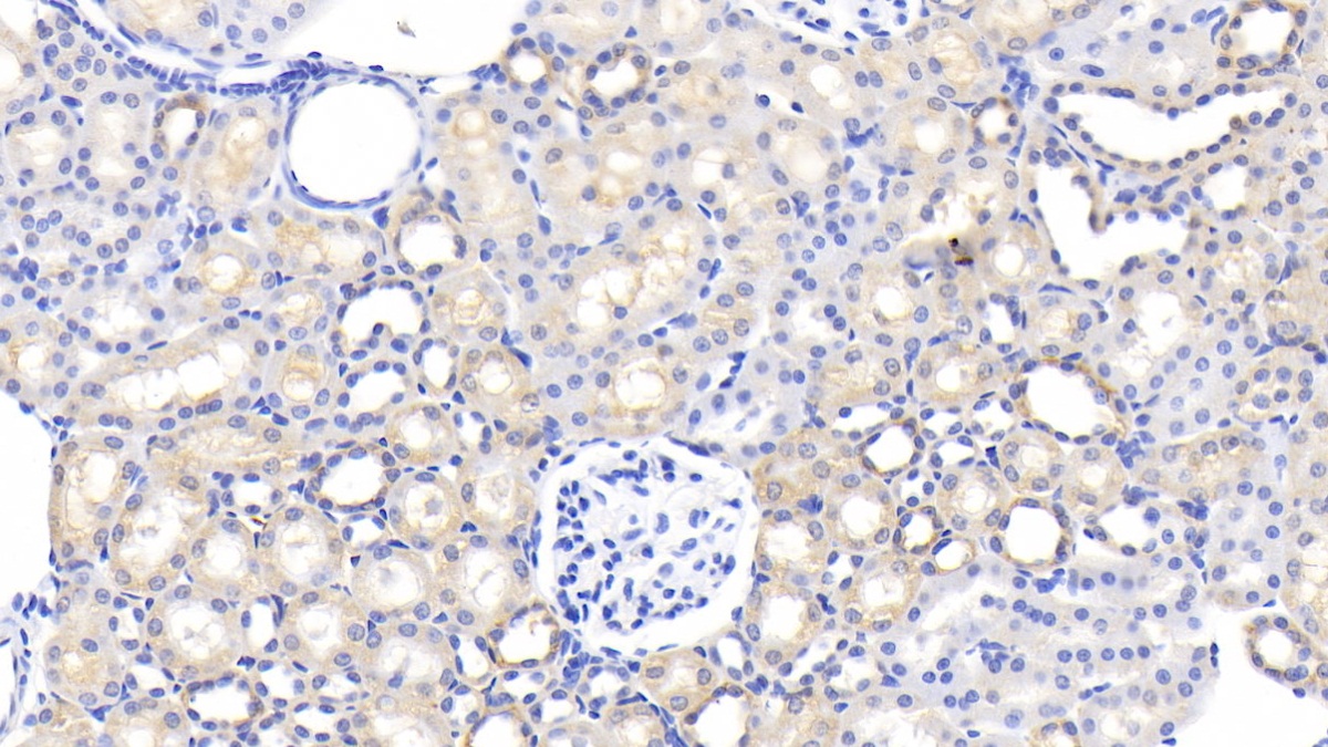 Polyclonal Antibody to Fibrinogen Alpha Chain (FGA)