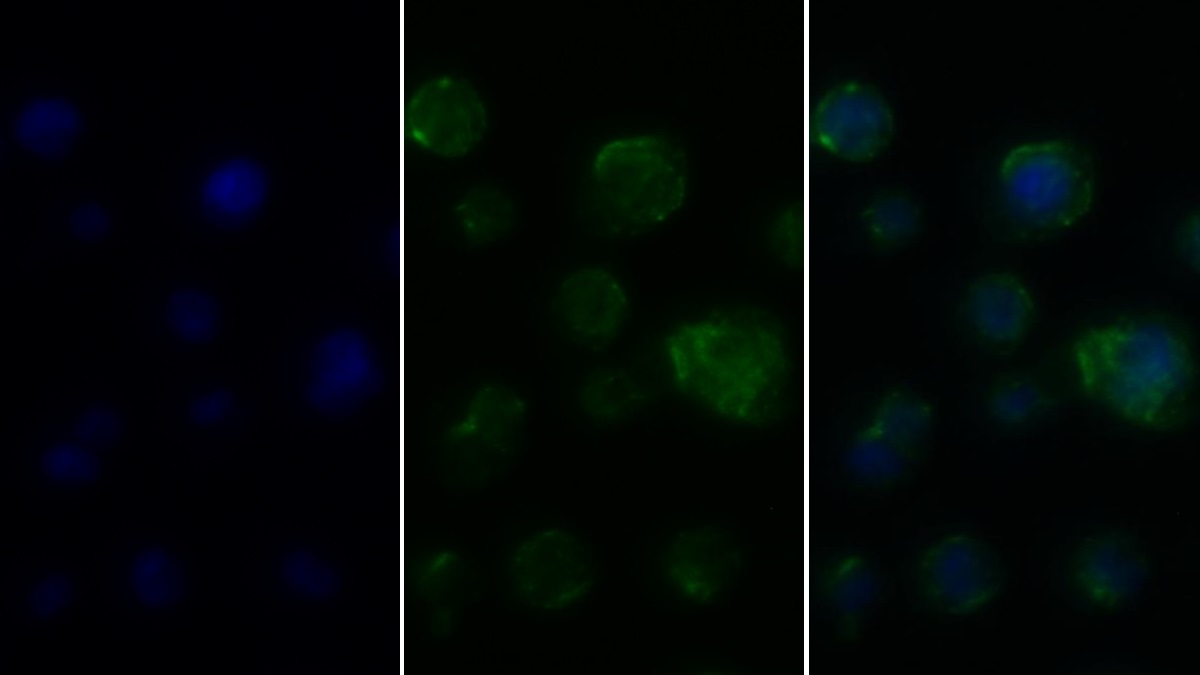 Polyclonal Antibody to Cluster Of Differentiation 4 (CD4)