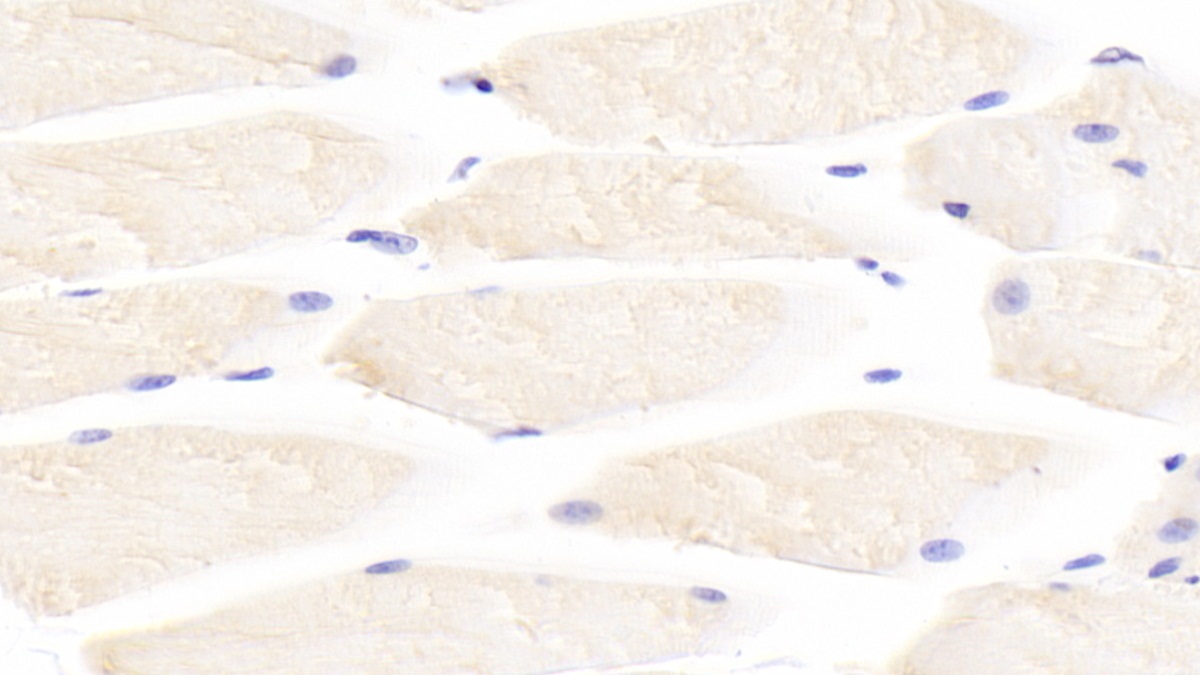 Polyclonal Antibody to Interleukin 31 (IL31)