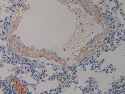 Polyclonal Antibody to Clusterin (CLU)