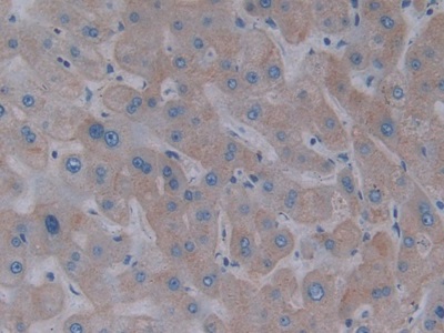 Polyclonal Antibody to Asialoglycoprotein Receptor 1 (ASGR1)