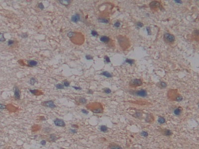 Polyclonal Antibody to Glia Maturation Factor Gamma (GMFg)