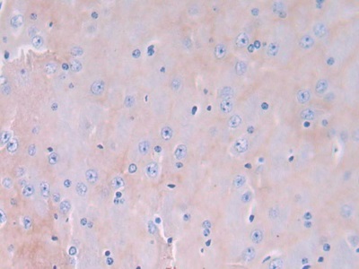Polyclonal Antibody to Glia Maturation Factor Gamma (GMFg)