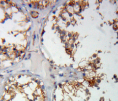 Polyclonal Antibody to Cartilage Oligomeric Matrix Protein (COMP)