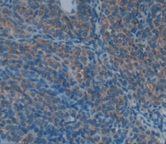 Polyclonal Antibody to Cartilage Oligomeric Matrix Protein (COMP)