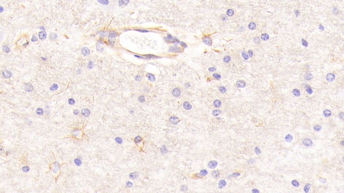 Polyclonal Antibody to Contactin 1 (CNTN1)