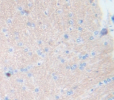 Polyclonal Antibody to Neurokinin B (NKB)