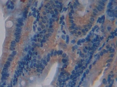 Polyclonal Antibody to Neurotensin (NT)