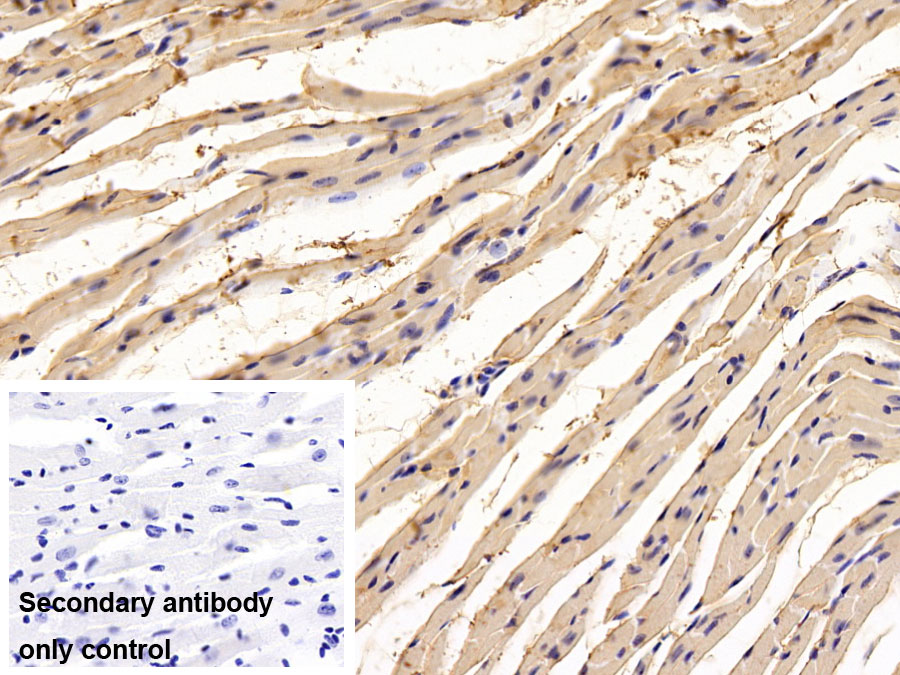 Polyclonal Antibody to Aspartate Aminotransferase (AST)