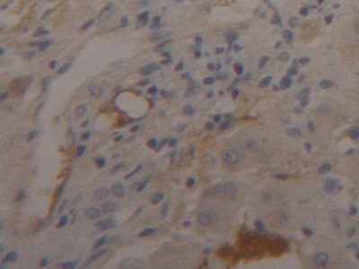 Polyclonal Antibody to Fibrinogen Beta Chain (FGB)