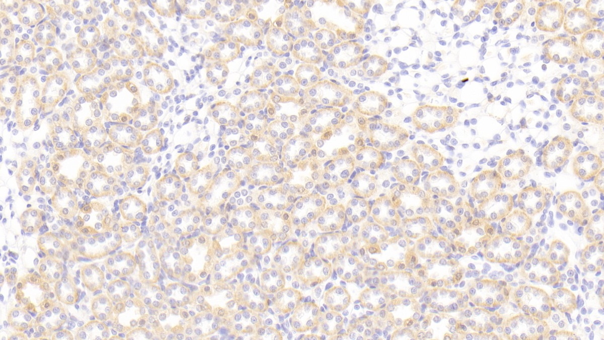 Polyclonal Antibody to Synuclein Alpha (SNCa)