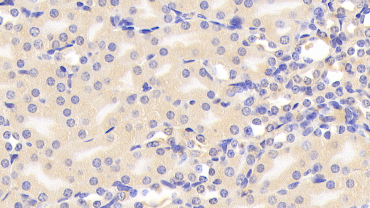 Polyclonal Antibody to Corticosteroid Binding Globulin (CBG)