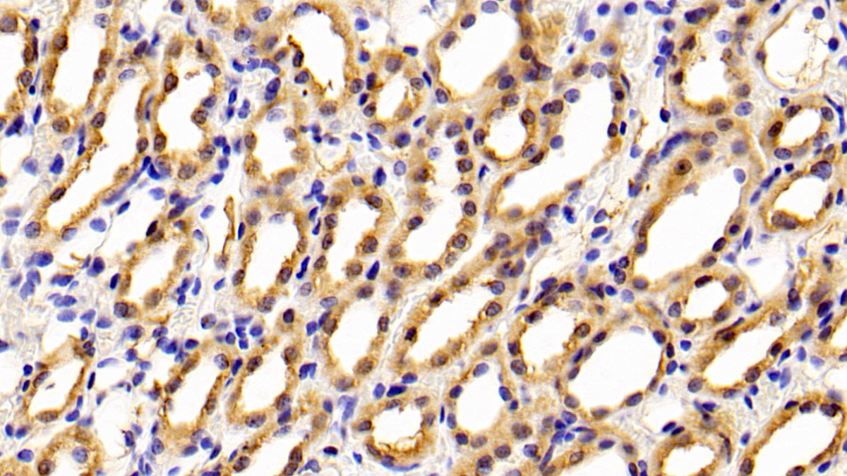 Polyclonal Antibody to Cytotoxic T-Lymphocyte Associated Antigen 4 (CTLA4)