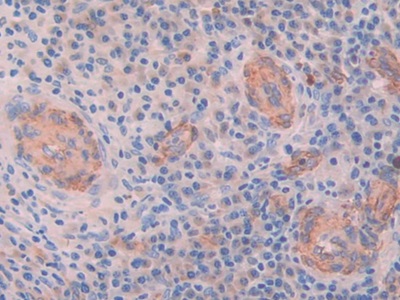 Polyclonal Antibody to Matrix Extracellular Phosphoglycoprotein (MEPE)