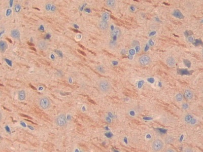 Polyclonal Antibody to Matrix Extracellular Phosphoglycoprotein (MEPE)