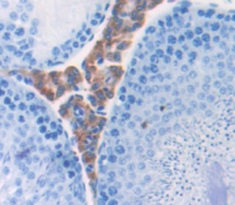 Polyclonal Antibody to Bactericidal/Permeability Increasing Protein (BPI)