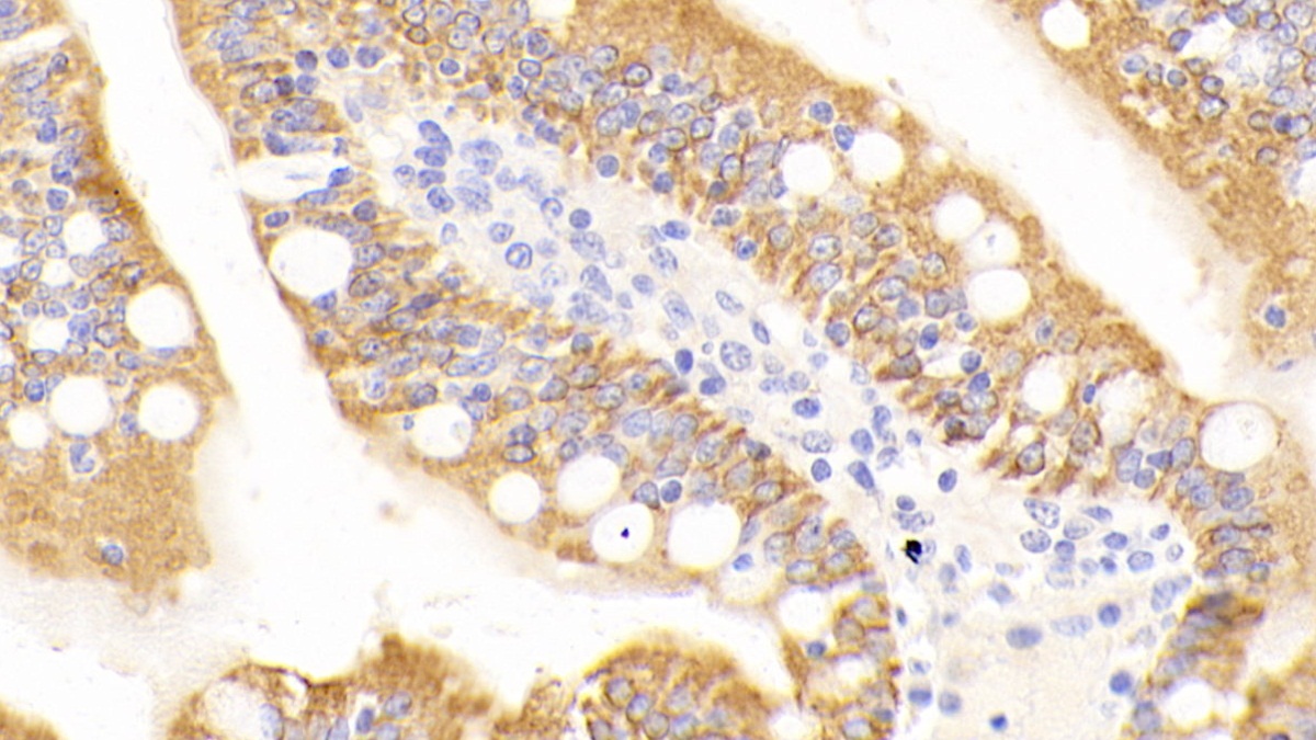 Polyclonal Antibody to Cytokeratin 19 (CK19)