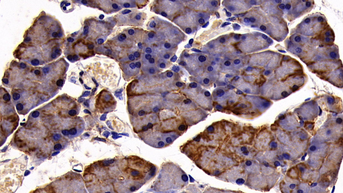 Polyclonal Antibody to Cytokeratin 19 (CK19)