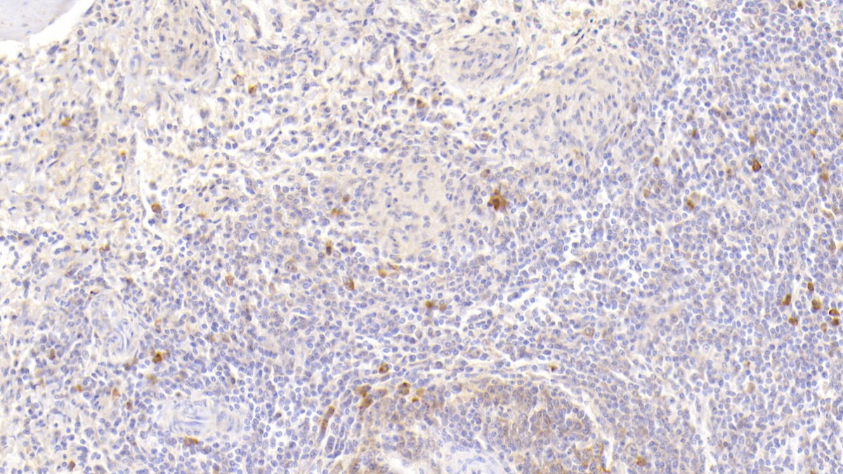 Polyclonal Antibody to Heart-type Fatty Acid Binding Protein (H-FABP)