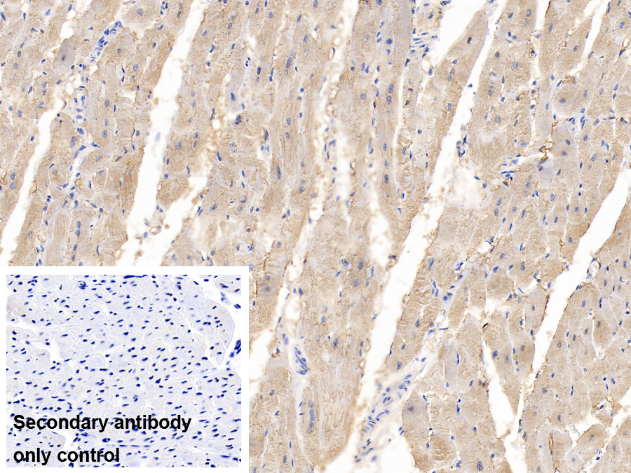 Polyclonal Antibody to Heart-type Fatty Acid Binding Protein (H-FABP)