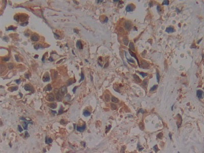 Polyclonal Antibody to Prolylcarboxypeptidase (PRCP)