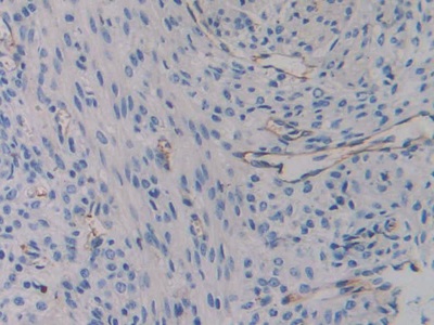 Polyclonal Antibody to Integrin Beta 3 (ITGb3)