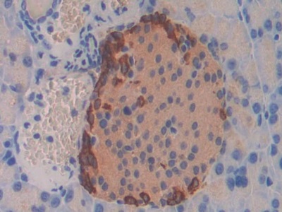 Polyclonal Antibody to Glucagon (GCG)