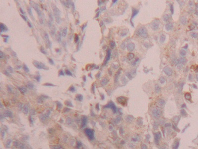 Polyclonal Antibody to Cathepsin D (CTSD)