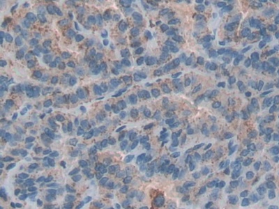 Polyclonal Antibody to Cathepsin D (CTSD)