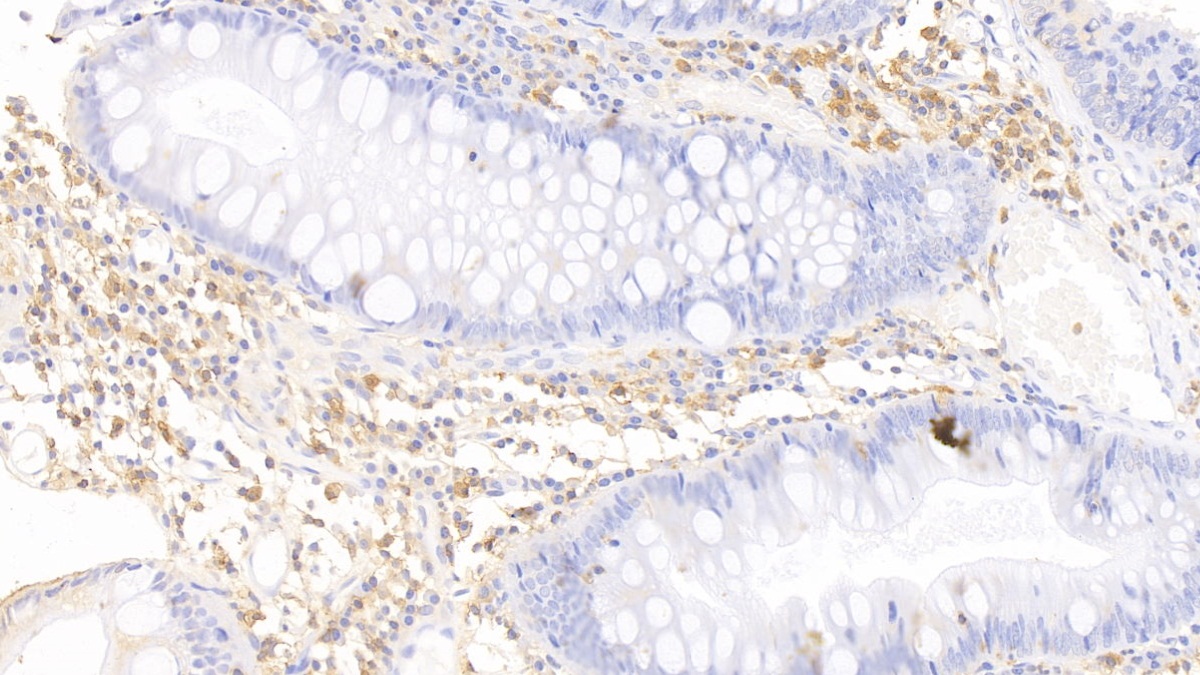 Polyclonal Antibody to Epithelial Cell Adhesion Molecule (EPCAM)