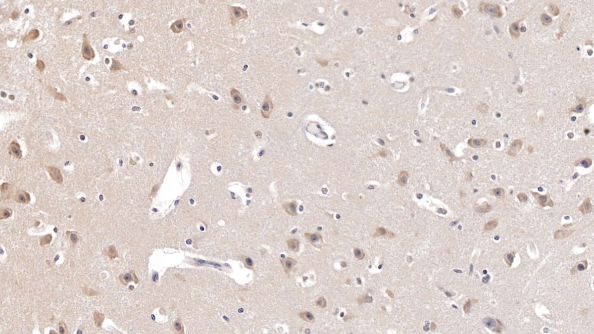 Polyclonal Antibody to Agouti Related Protein (AGRP)