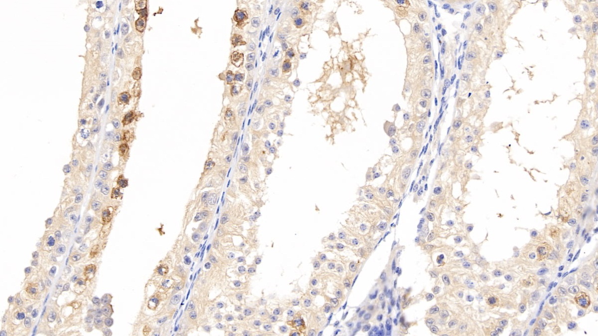 Polyclonal Antibody to Pleiotrophin (PTN)